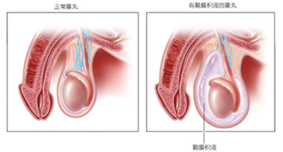 1-150114162S5108.png